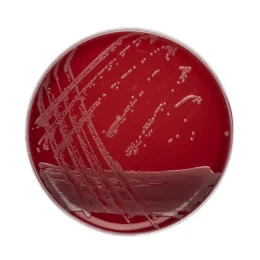 Columbia Agar