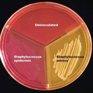 Mannitol Salt Agar